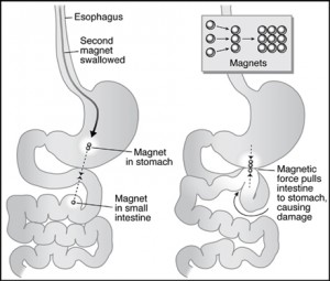 magnet intestine